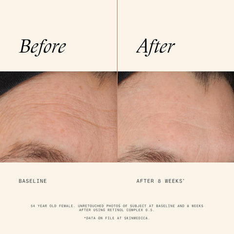 SkinMedica Retinol Complex 0.5(1oz)