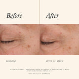 SkinMedica Retinol Complex 1.0  (1oz)