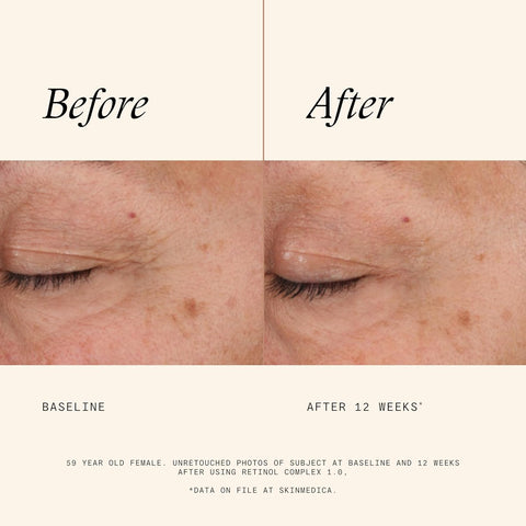 SkinMedica Retinol Complex 1.0  (1oz)