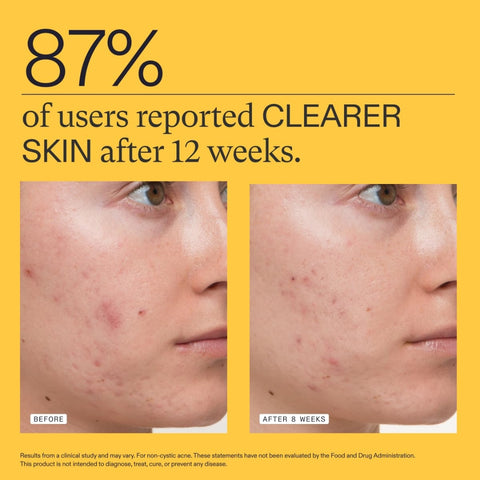 Nutrafol Clear Skin Supplement for Women – 1 Month Supply | Supports Skin Clarity & Wellness