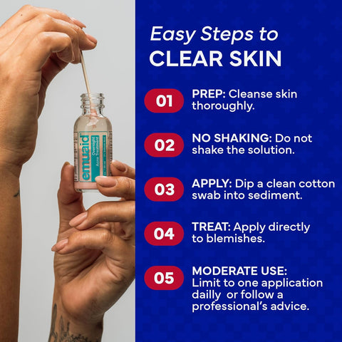 Emuaid Overnight Acne Treatment -  1oz 30ml