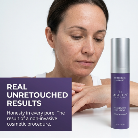 Alastin Regenerating Skin Nectar with TriHex Technology 1oz – Pre & Post-Procedure Serum