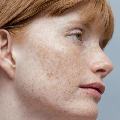 Obagi Nu-Derm Toner – 2 oz, Refreshing Facial Toner for Balanced, Refined Skin