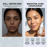 Epicutis Arctigenin Brightening Treatment (ABT) 1oz 30ml – Novel ABSO Brightening Serum