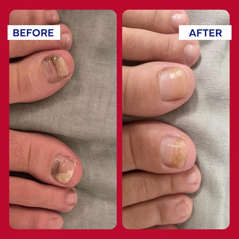 Emuaid EMUAIDMAX Concentrate First Aid Serum – 1 oz | Maximum Strength Relief for Skin Irritations & Wounds