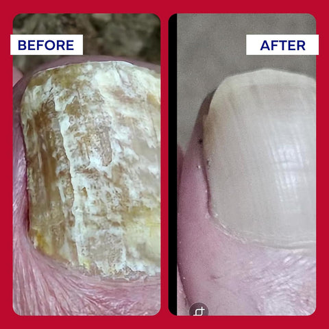 Emuaid EMUAIDMAX Concentrate First Aid Serum – 1 oz | Maximum Strength Relief for Skin Irritations & Wounds