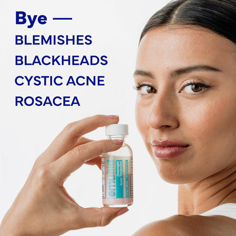 Emuaid Overnight Acne Treatment -  1oz 30ml