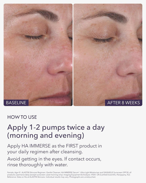 Alastin HA   (Hyaluronic Acid)   Immerse Serum 1 oz