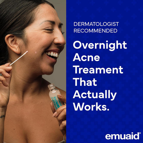 Emuaid Overnight Acne Treatment -  1oz 30ml