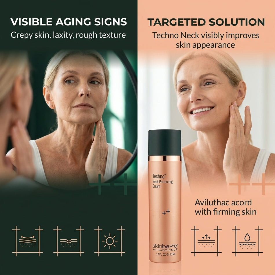 skinbetter science Techno Neck Perfecting Cream 50ml – Neck & Décolleté Anti-Aging
