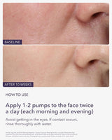 ALASTIN Skincare Restorative Skin Complex with TriHex Technology  Travel 0.5 oz