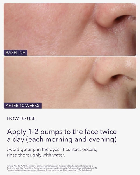 ALASTIN Skincare Restorative Skin Complex with TriHex Technology  Travel 0.5 oz