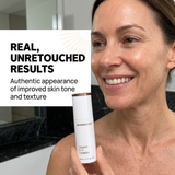 SkinMedica Vitamin C + E Complex – Antioxidant Brightening Serum