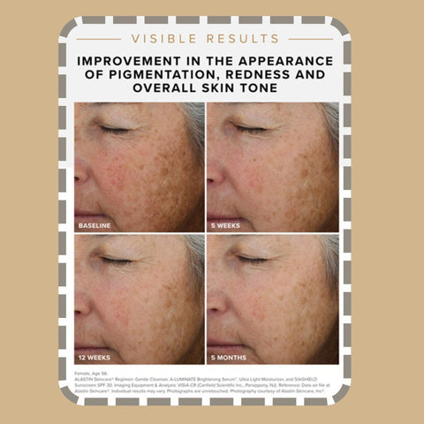 alastin-a-luminate-brightening-serum.jpg