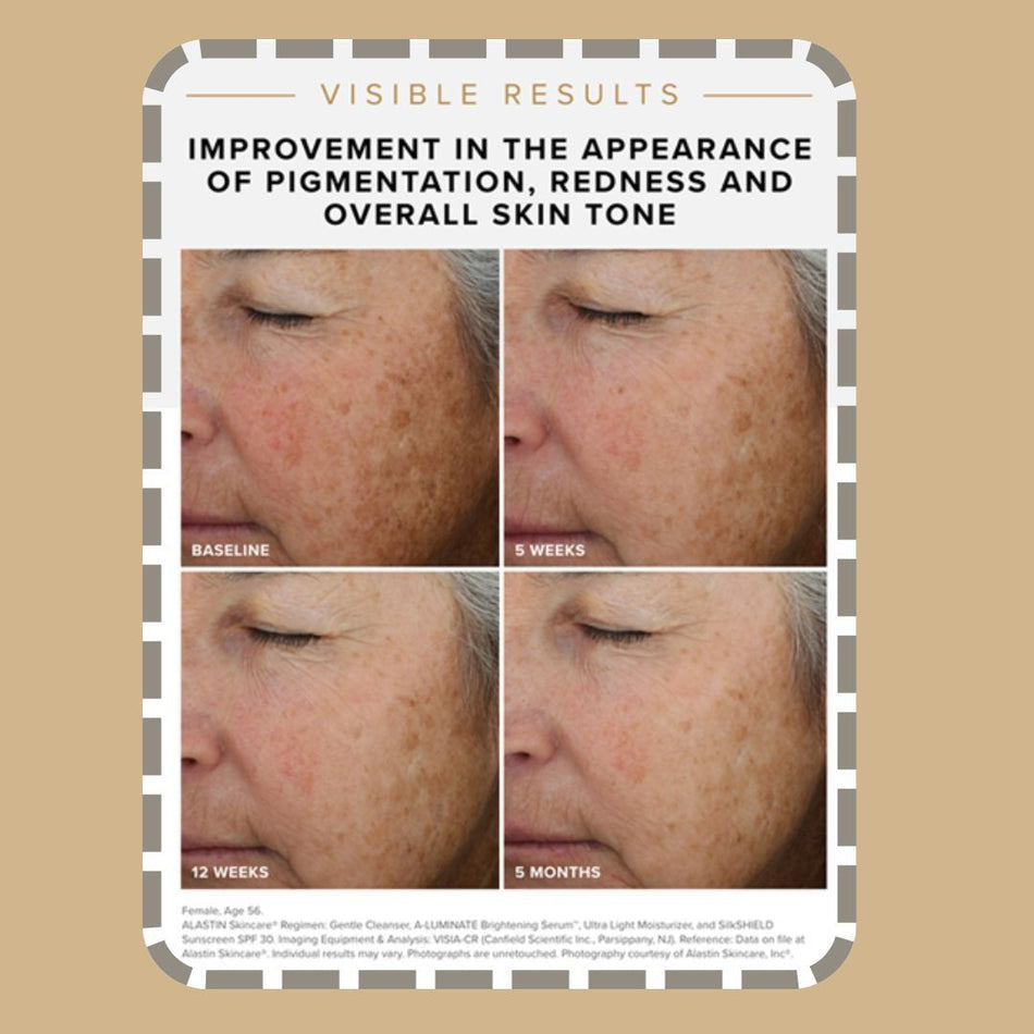 alastin-a-luminate-brightening-serum.jpg