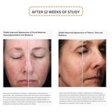 alastin-c-radical-defense-serum-texture.jpg