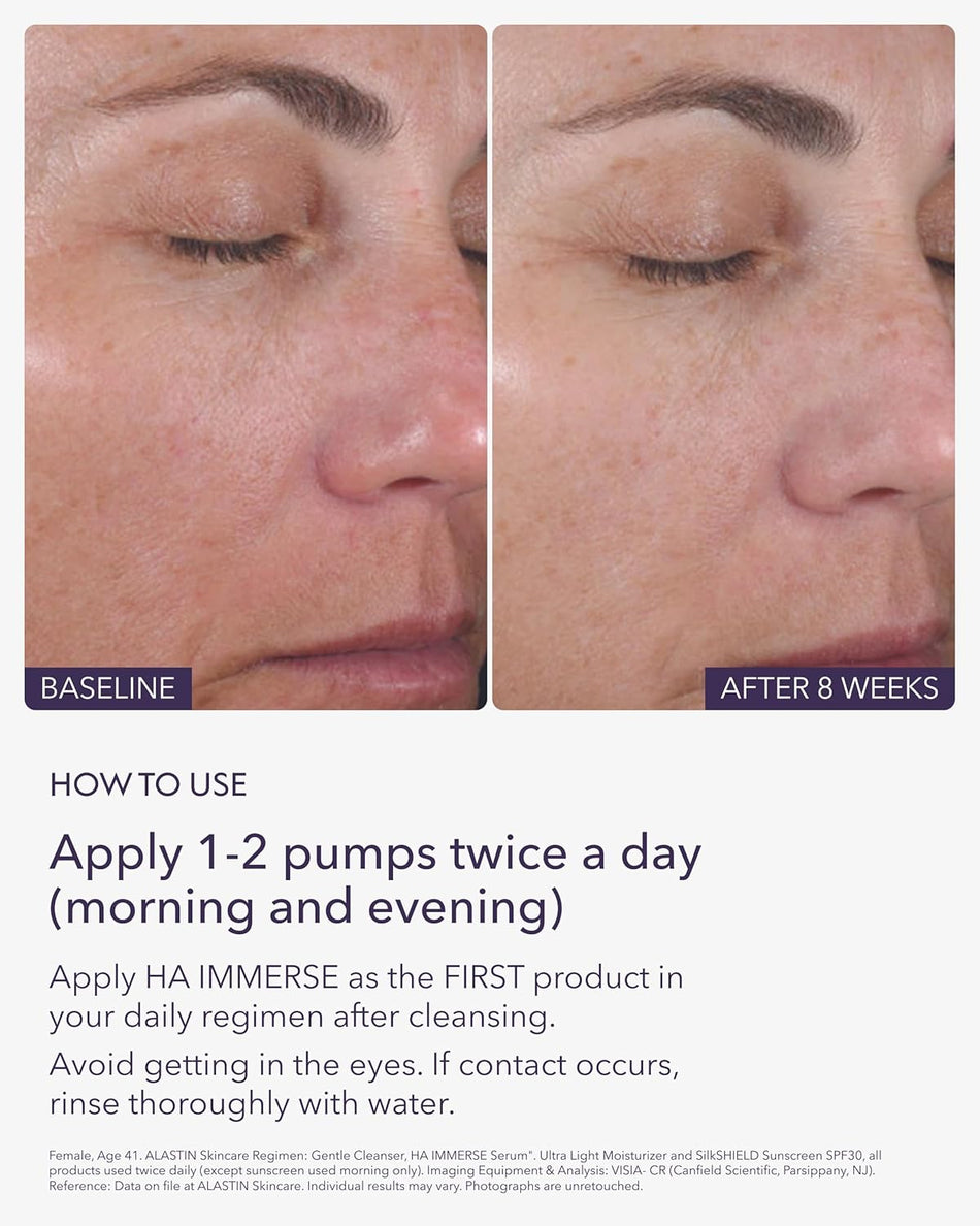 alastin-ha-immerse-serum-application.jpg
