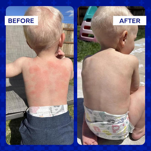 Emuaid First Aid Ointment -  2oz 59ml