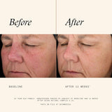 SkinMedica Retinol Complex .25 – 1oz | Anti-Aging Skincare for Smooth & Radiant Skin