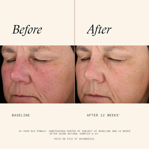 SkinMedica Retinol Complex .25 – 1oz | Anti-Aging Skincare for Smooth & Radiant Skin