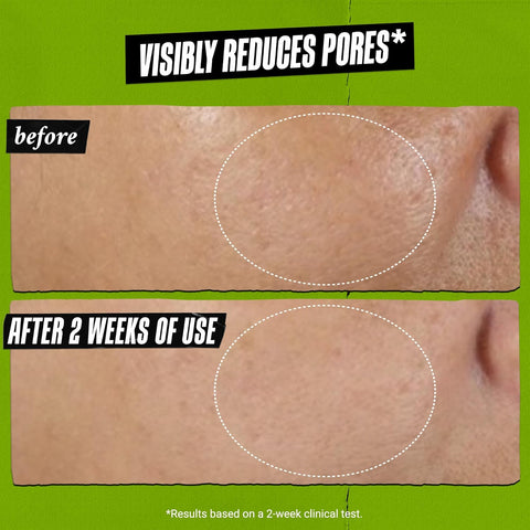 Kiehl's Rare Earth Deep Pore Cleansing Masque 125 ml