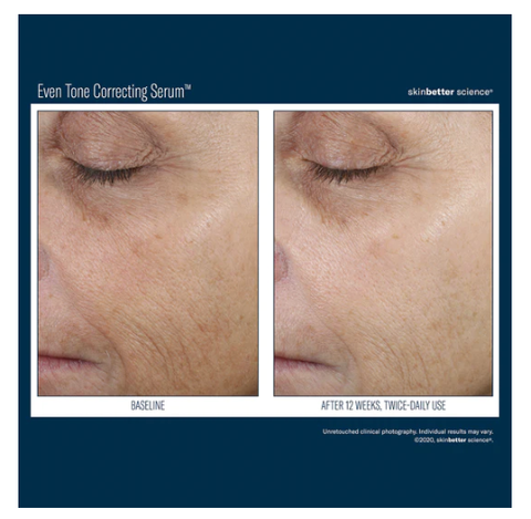 Skinbetter Even Tone Correcting Serum  1.7 oz 50 ml