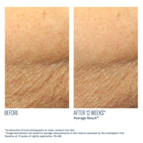 skinbetter-alpharet-body-overnight-cream-travel-size.jpg
