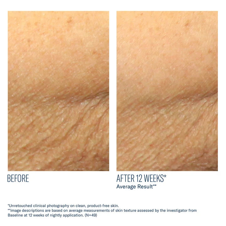 skinbetter-alpharet-body-overnight-cream-travel-size.jpg